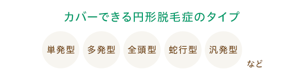 カバーできる円形脱毛症のタイプ 単発型/多発型/全頭型/蛇行型/汎発型など