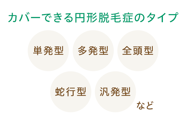 カバーできる円形脱毛症のタイプ 単発型/多発型/全頭型/蛇行型/汎発型など