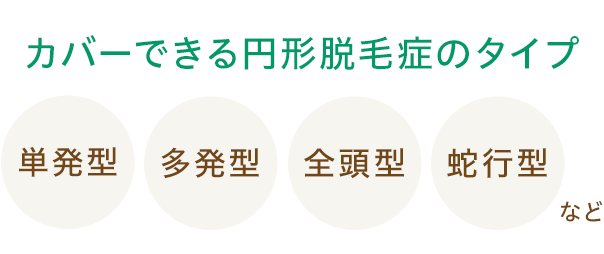 カバーできる円形脱毛症のタイプ 多発型/全頭型/蛇行型など